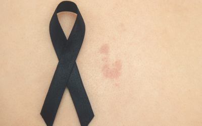Skin Cancer Awareness Month: FAQs, Early Detection, and Prevention