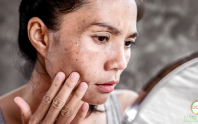 Common Skin Conditions: Causes, Symptoms, and Treatment