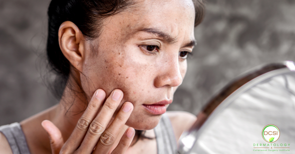 Common Skin Conditions: Causes, Symptoms, and Treatment